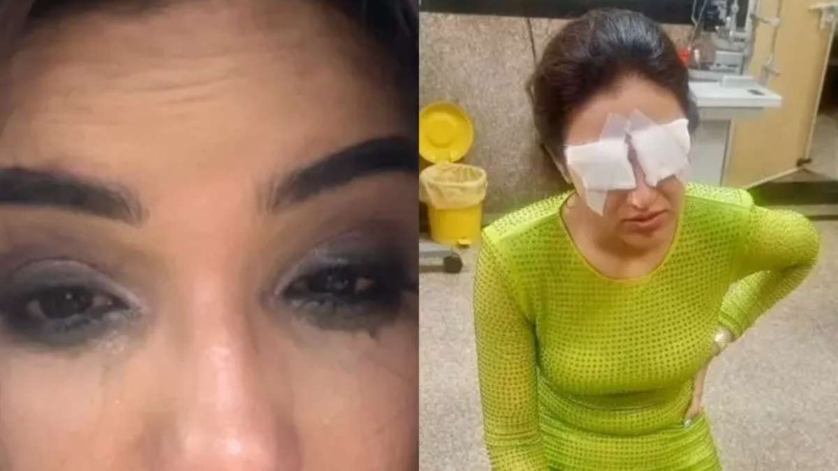 Jasmine Bhasin makes her first public appearance after suffering from Cornea damage