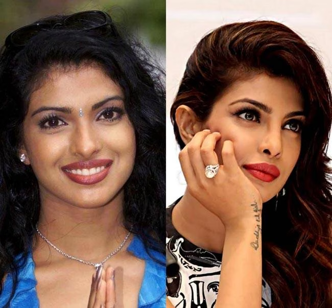 Priyanka Chopra before vs after cosmetic surgery